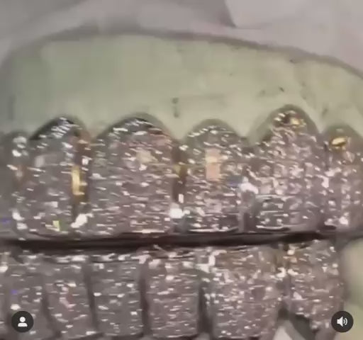Iced Out Custom Grillz in Miami