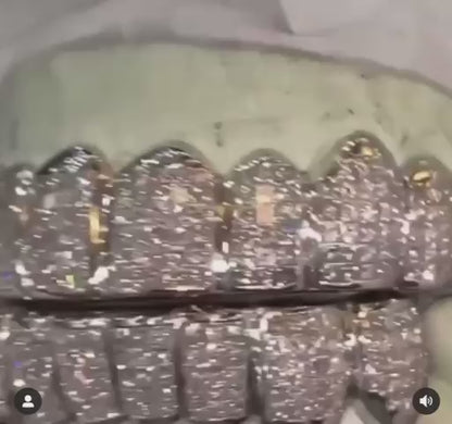Iced Out Custom Grillz in Miami